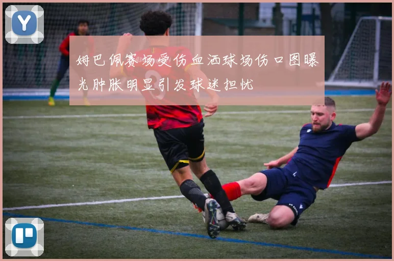姆巴佩赛场受伤血洒球场伤口图曝光肿胀明显引发球迷担忧